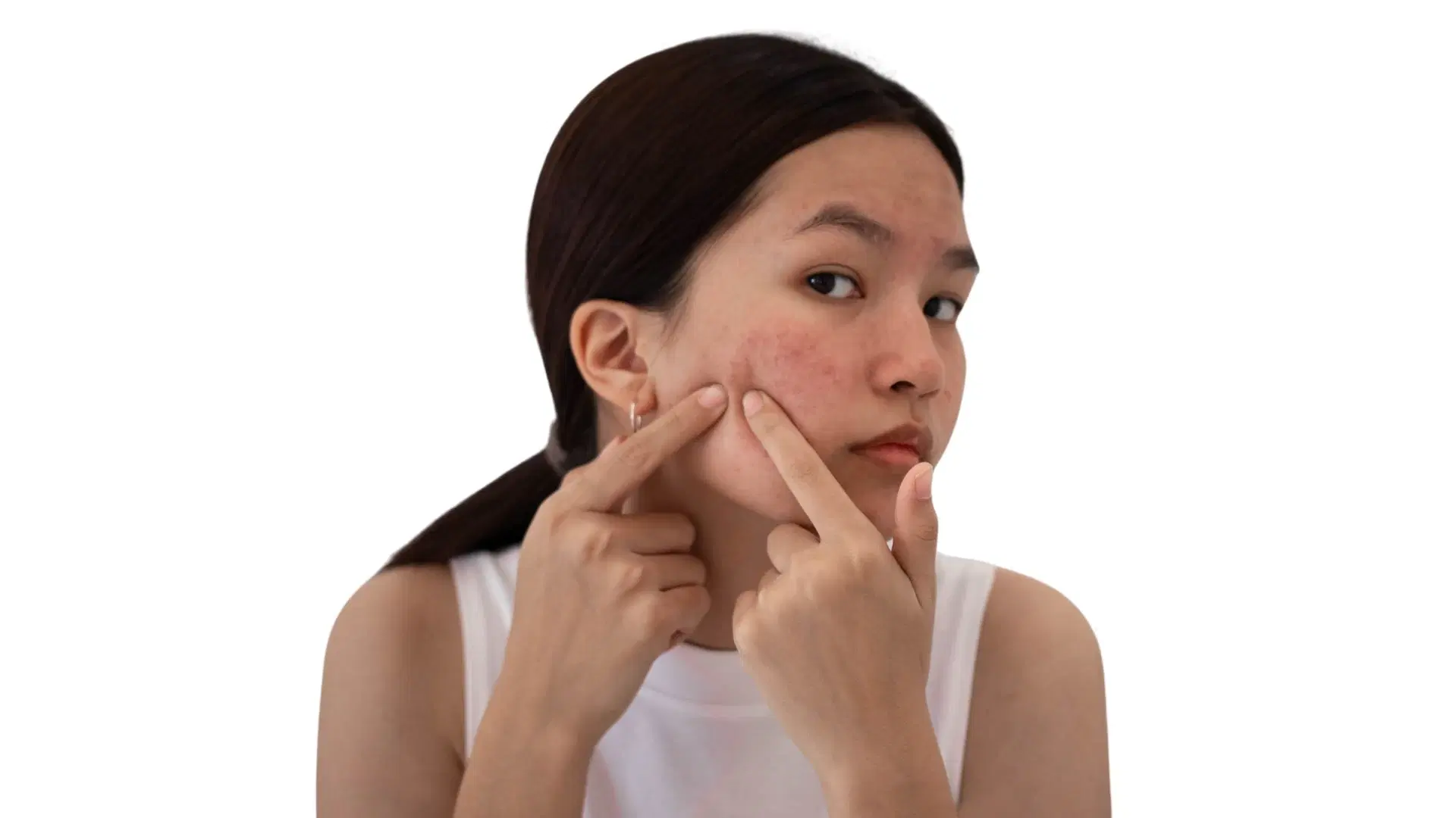 FAQs on Hyperpigmentation: Treatments and Skin Remedies