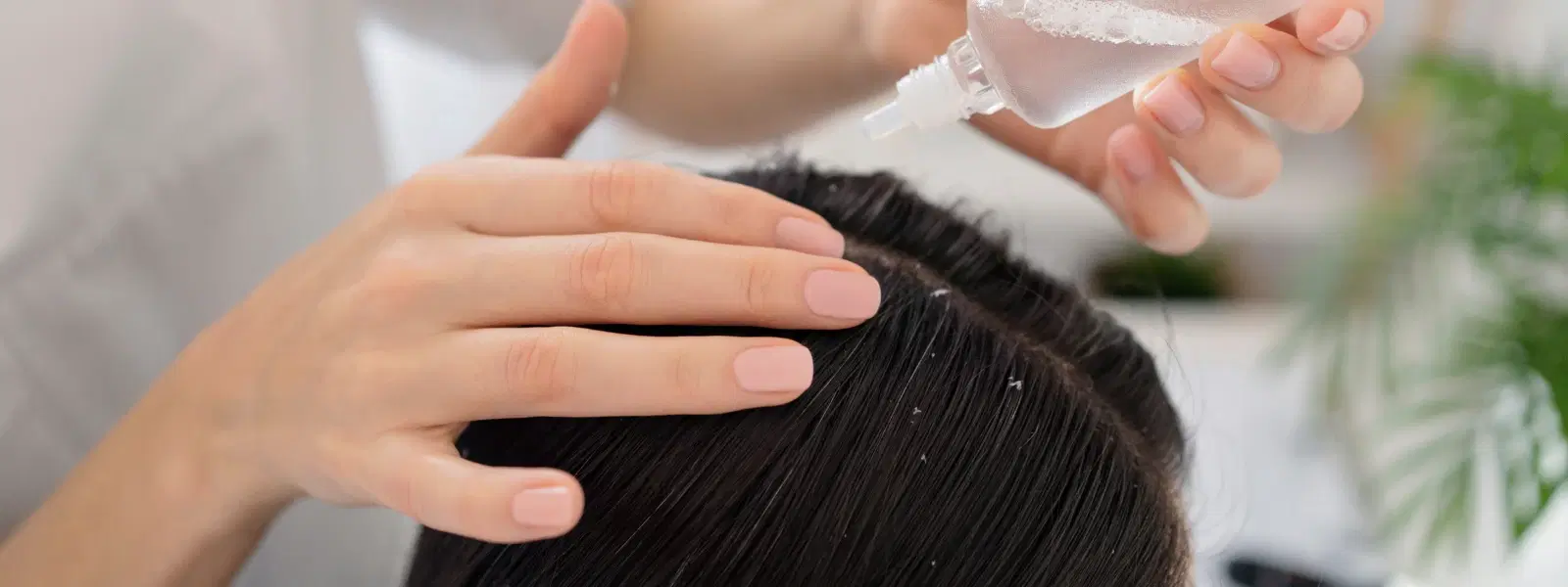 FAQs on Scalp Care: Tips for a Healthy Scalp Routine