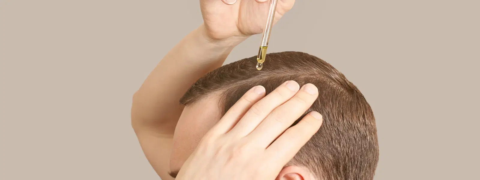 Scalp Care vs. Scalp Treatment: What’s Right for You?