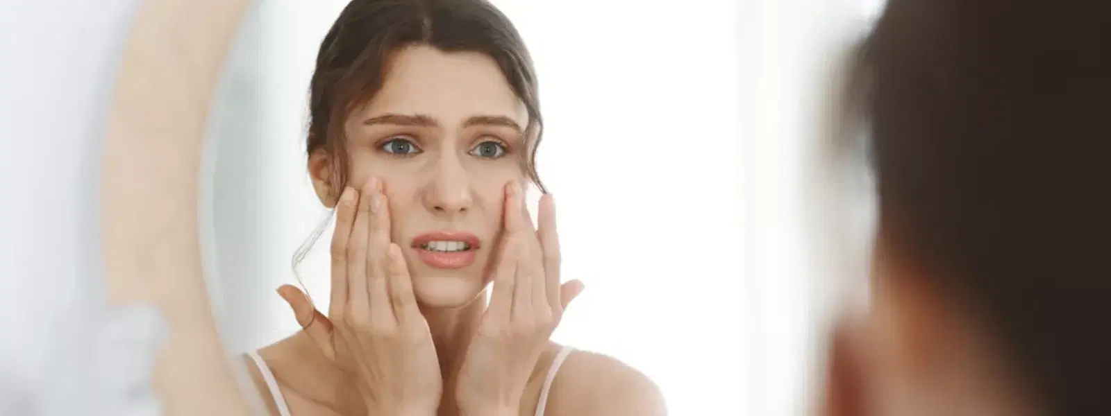 Step-by-Step Guide to Treating White Spots on Skin