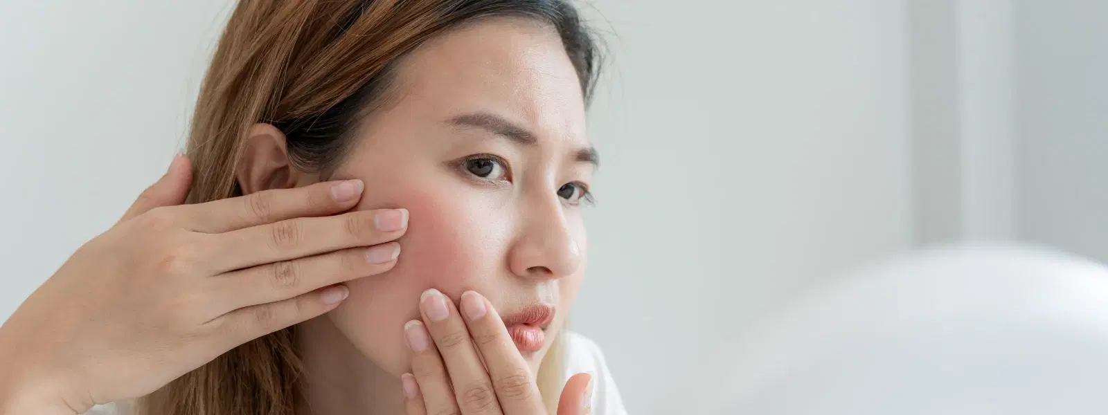 Your Essential Checklist for Seborrheic Dermatitis Care